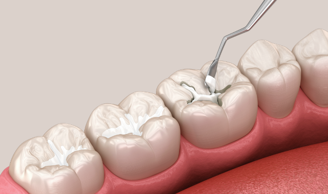 Treatments - Church View Dental