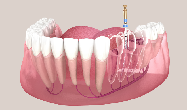 Treatments - Church View Dental
